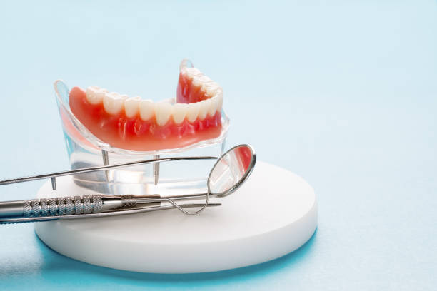 Dental Inlays and Onlays in Perryton, TX