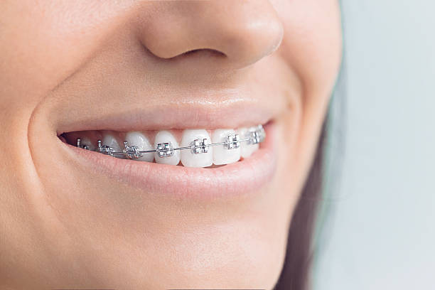 Best Veneers and Lumineers  in Perryton, TX